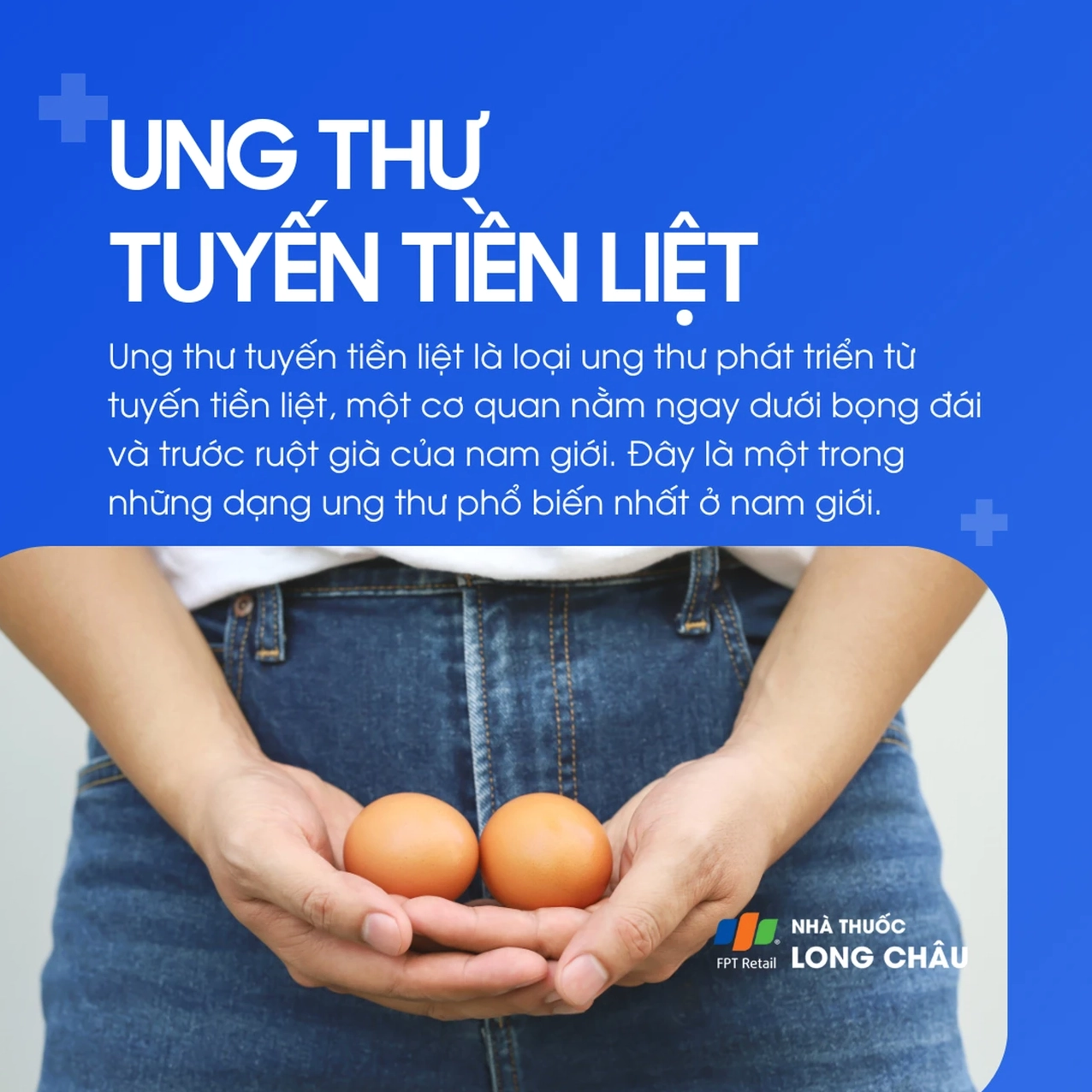 Đồ họa thông tin tổng quan về các nguyên nhân và yếu tố nguy cơ gây ung thư tuyến tiền liệt.