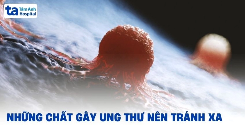 Những chất gây ung thư phổ biến nên tránh để phòng ngừa bệnh tật