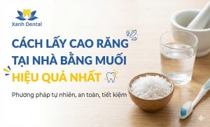 Bạn tìm địa chỉ lấy cao răng Nhổn uy tín? Khám phá Nha Khoa Xanh Dental CS2 (93 Phố Nhổn) - cạo vôi răng sóng siêu âm không đau, sạch bong mảng bám, giá tốt.